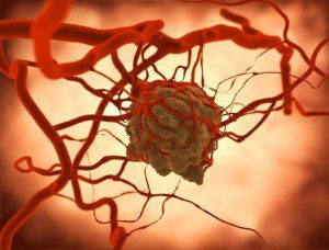 Tumor angebunden an Blutbahnen